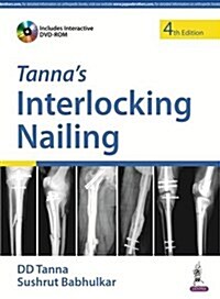 TannaS Interlocking Nailing With Dvd-Rom (Paperback, 4)