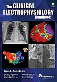 The Clinical Cardiac Electrophysiology Handbook (Paperback)
