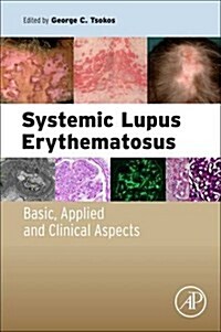 Systemic Lupus Erythematosus: Basic, Applied and Clinical Aspects (Paperback)