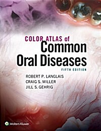 Color Atlas of Common Oral Diseases (Paperback)