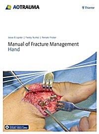 Manual of Fracture Management - Hand (Hardcover)