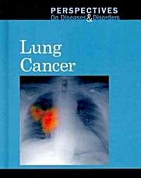 Lung Cancer (Library Binding)