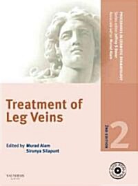 Treatment of Leg Veins (Hardcover, DVD-ROM, 2nd)