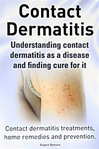 Contact Dermatitis. Contact Dermatitis Treatments, Home Remedies and Prevention. Understanding Contact Dermatitis as a Disease and Finding Cure for It (Paperback)