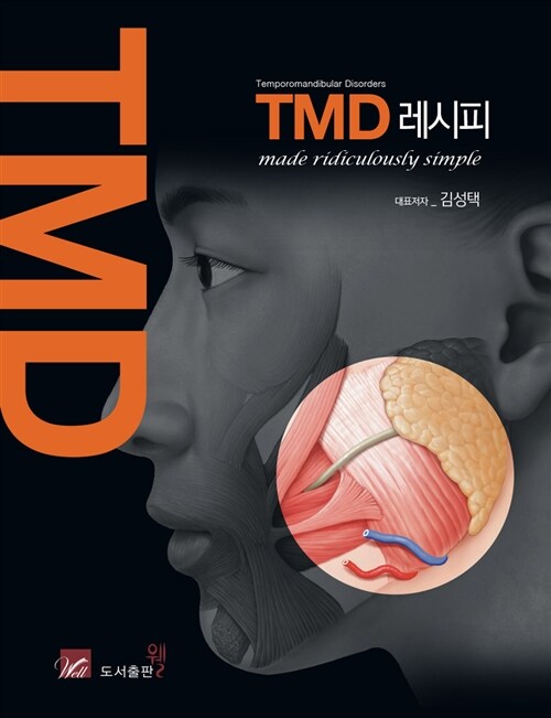 TMD 레시피 Made Ridiculously Simple