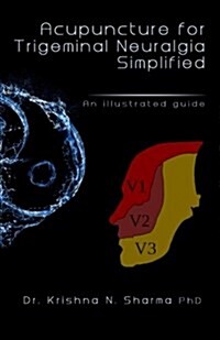 Acupuncture for Trigeminal Neuralgia Simplified: An Illustrated Guide (Paperback)