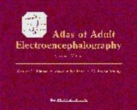 Atlas of adult electroencephalography 2nd ed