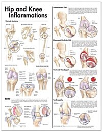 Hip And Knee Inflammations Chart (Chart, 1st)