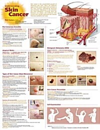 Understanding Skin Cancer (Chart, LAM)