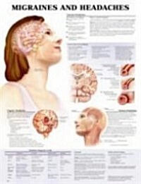 Migraines And Headaches Chart (Chart, 1st)
