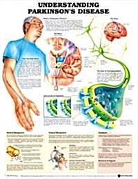 Understanding Parkinsons Disease Anatomical Chart (Chart, Wall)