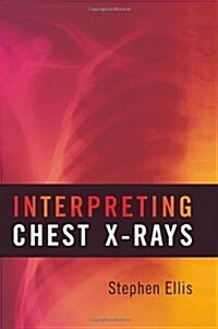 Interpreting Chest X-rays (Paperback)