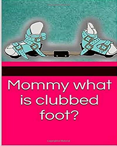 Mommy What Is Clubbed Foot? (Paperback)