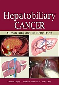 Hepatobiliary Cancer (Hardcover)