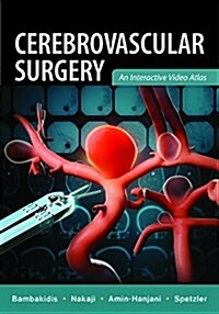 Cerebrovascular Surgery (Hardcover)