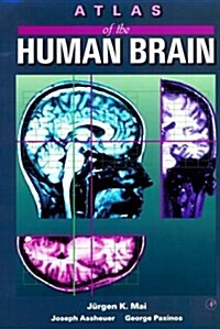 Atlas of the Human Brain (Paperback)