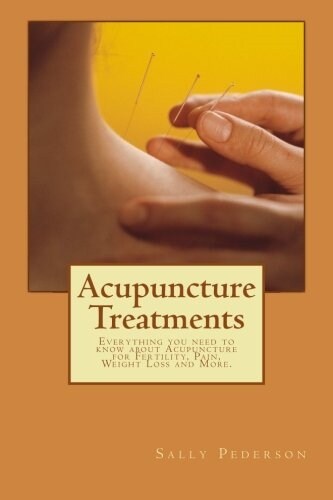 Acupuncture Treatments: Everything You Need to Know about Acupuncture for Fertility, Pain, Weight Loss and More. (Paperback)