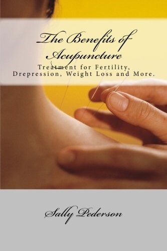 The Benefits of Acupuncture (Paperback)