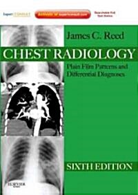 Chest Radiology: Plain Film Patterns and Differential Diagnoses [With Access Code] (Hardcover, 6)