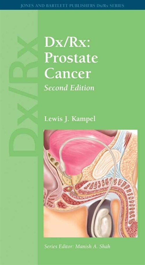 DX/Rx: Prostate Cancer: Prostate Cancer (Paperback, 2)