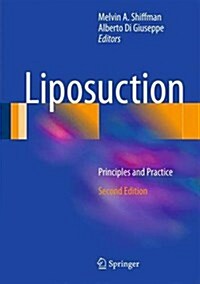 Liposuction: Principles and Practice (Hardcover, 2)