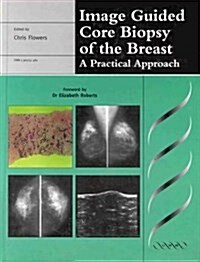 Image Guided Core Biopsy of the Breast: A Pratical Guide (Hardcover)