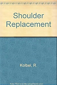 Shoulder Replacement (Hardcover, 1)