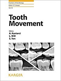 Tooth Movement (Hardcover)