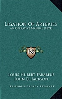 Ligation of Arteries: An Operative Manual (1874) (Hardcover)