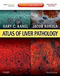 Atlas of Liver Pathology: Expert Consult - Online and Print (Hardcover, 3rd)