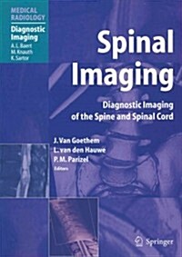 Spinal Imaging: Diagnostic Imaging of the Spine and Spinal Cord (Paperback)