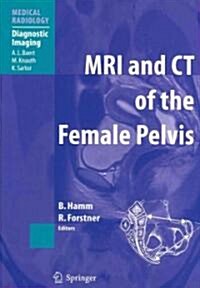 MRI and CT of the Female Pelvis (Paperback, 1st)
