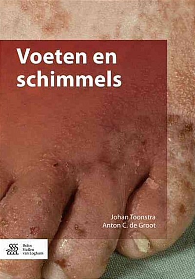 Voeten En Schimmels (Paperback, 2016)