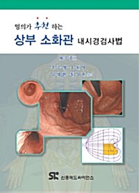 상부 소화관 내시경검사법