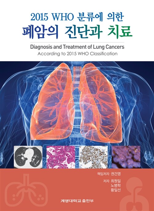 2015 WHO 분류에 의한 폐암의 진단과 치료