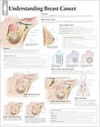 Understanding Breast Cancer Wall Chart (Other)