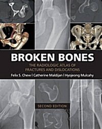 Broken Bones : The Radiologic Atlas of Fractures and Dislocations (Paperback, 2 Revised edition)