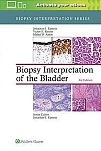 Biopsy Interpretation of the Bladder (Hardcover, 3)