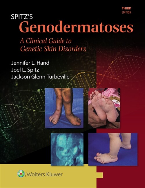 Spitzs Genodermatoses: A Full Color Clinical Guide to Genetic Skin Disorders (Hardcover, 3)