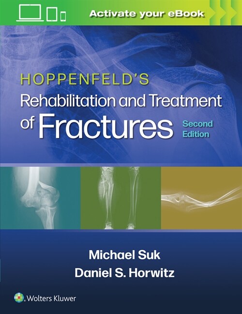 Hoppenfelds Rehabilitation and Treatment of Fractures (Paperback, 2)