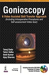 Gonioscopy: A Video Assisted Skill Transfer Approach (Hardcover)