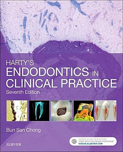 Hartys Endodontics in Clinical Practice (Paperback, 7 ed)