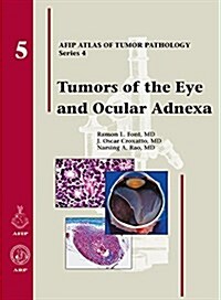 Tumors of the Eye and Ocular Adnexa (Hardcover, 1st)