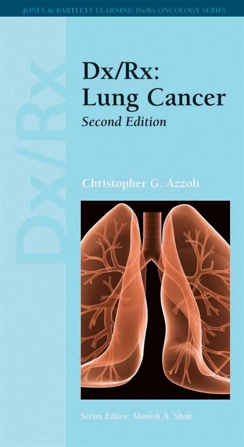 DX/Rx: Lung Cancer: Lung Cancer (Paperback, 2, Revised)