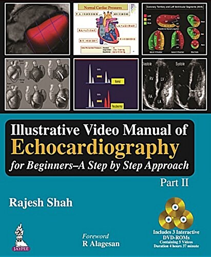 Illustrative Video Manual of Echocardiography for Beginners: A Step by Step Approach (Part II) (Hardcover)