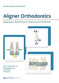 Aligner Orthodontics: Diagnostics, Biomechanics, Planning, and Treatment (Hardcover)