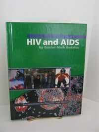 HIV and AIDS 표지이미지