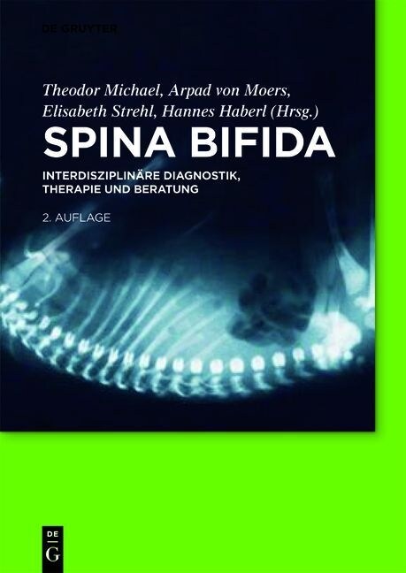Spina Bifida (Hardcover, 2, 2., Komplett Ub)