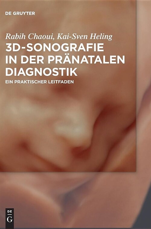 3d-Sonografie in Der Pr?atalen Diagnostik (Hardcover)