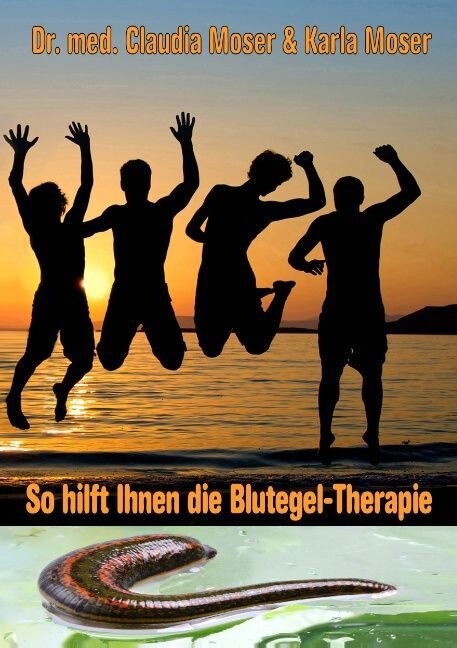 So Hilft Ihnen Die Blutegeltherapie (Paperback)